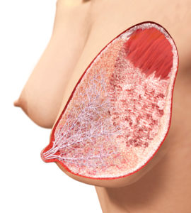 breast_3_illustration_small